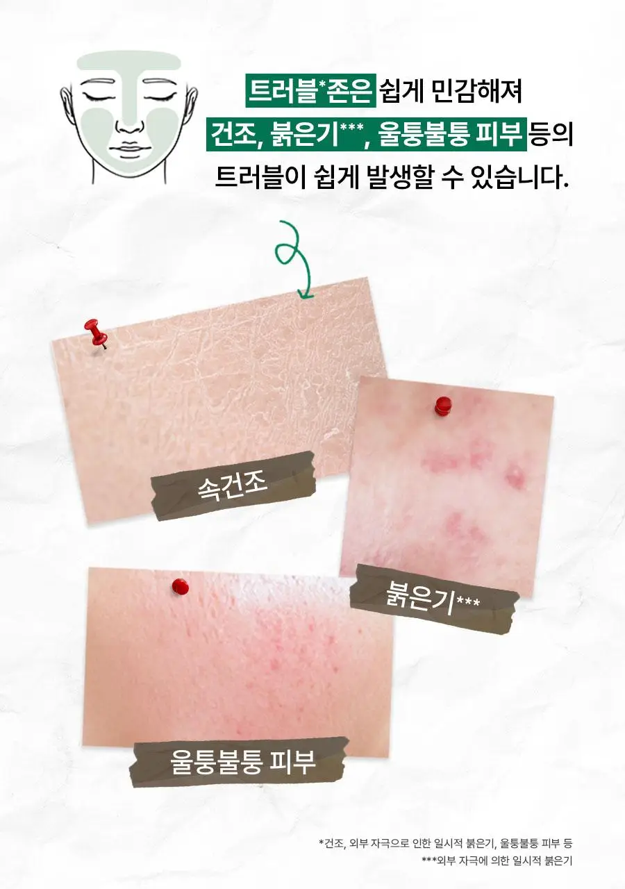 [트러블진정] 한율 어린쑥 5분 트러블진정패드 60+10매 (어린쑥패드) 상세페이지 13